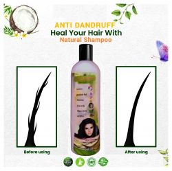 Astang Anti Dandruff Shampoo