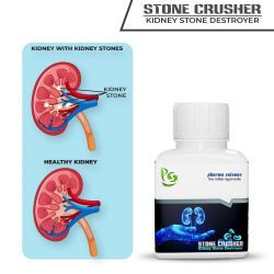Pharma Science Stone Crusher Ayurvedic Medicine for Kidney Stone -Pack of 1