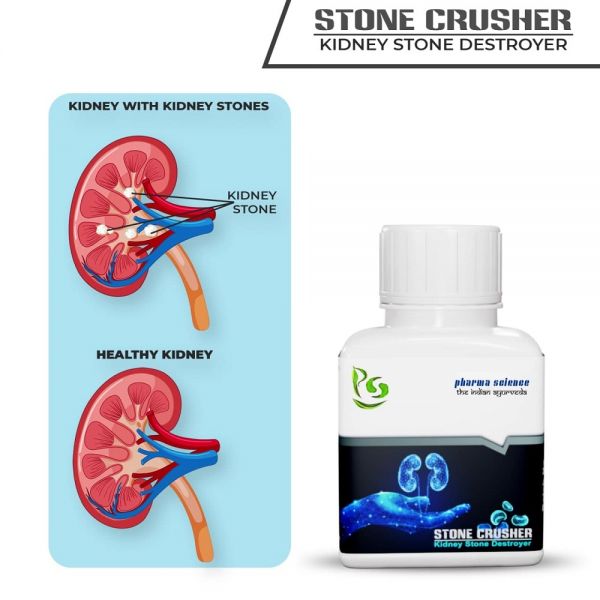 Pharma Science Stone Crusher Ayurvedic Medicine for Kidney Stone -Pack of 1